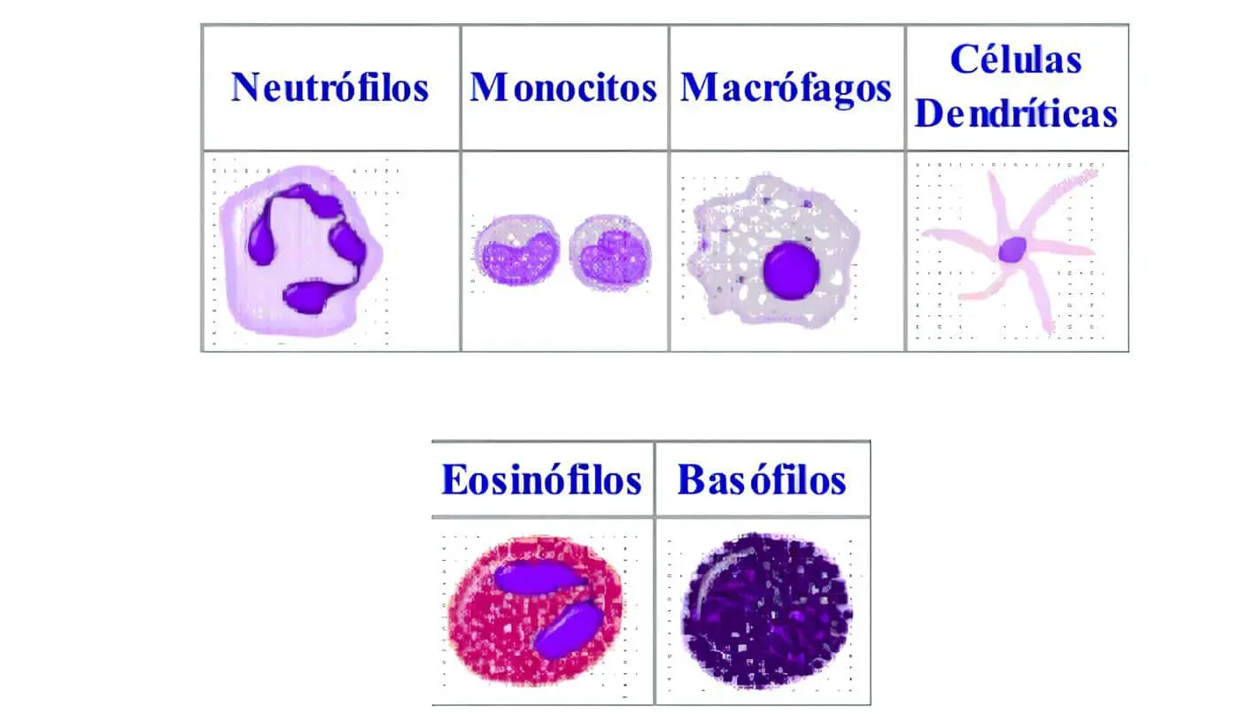 Deficiencia de las Células Fagocíticas