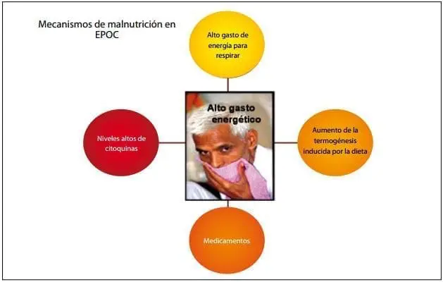 Mecanismos de malnutrición en EPOC. Alto gasto energético