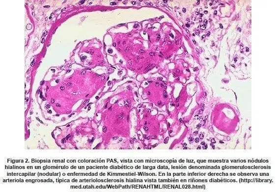 Biopsia Renal con Coloración