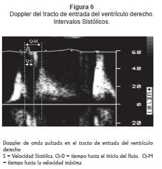 Doppler ventriculo derecho