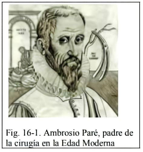 Ambrosio Paré
