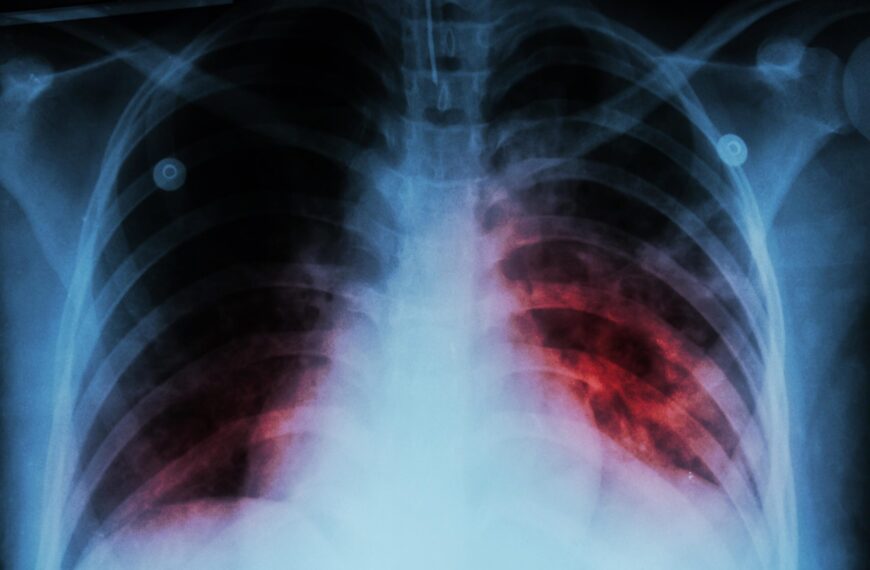 Características psicosexuales de las personas adultas con tuberculosis pulmonar