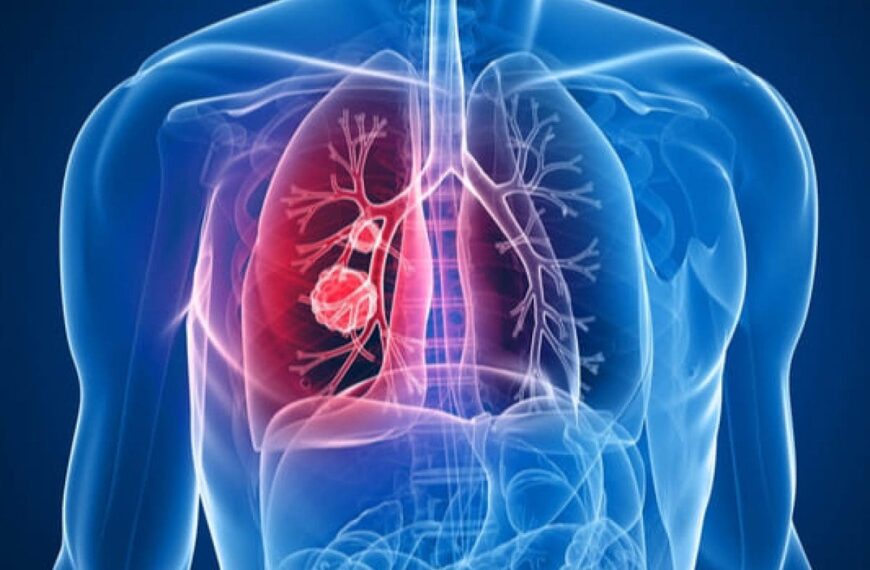 Embolismo pulmonar: comparación prospectiva de la tac helicoidal con la gammagrafía de ventilación- perfusión