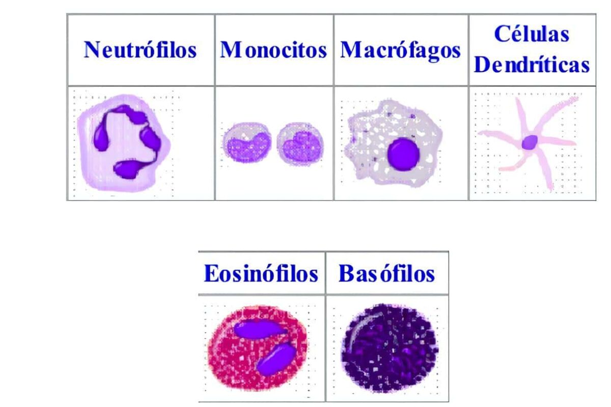 Deficiencia de las Células Fagocíticas