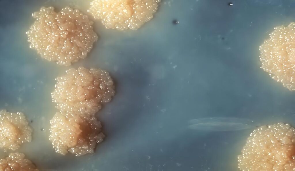 Macrófagos Murinos Infectados con Micobacterium Tuberculosis