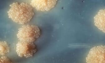 Macrófagos Murinos Infectados con Micobacterium Tuberculosis