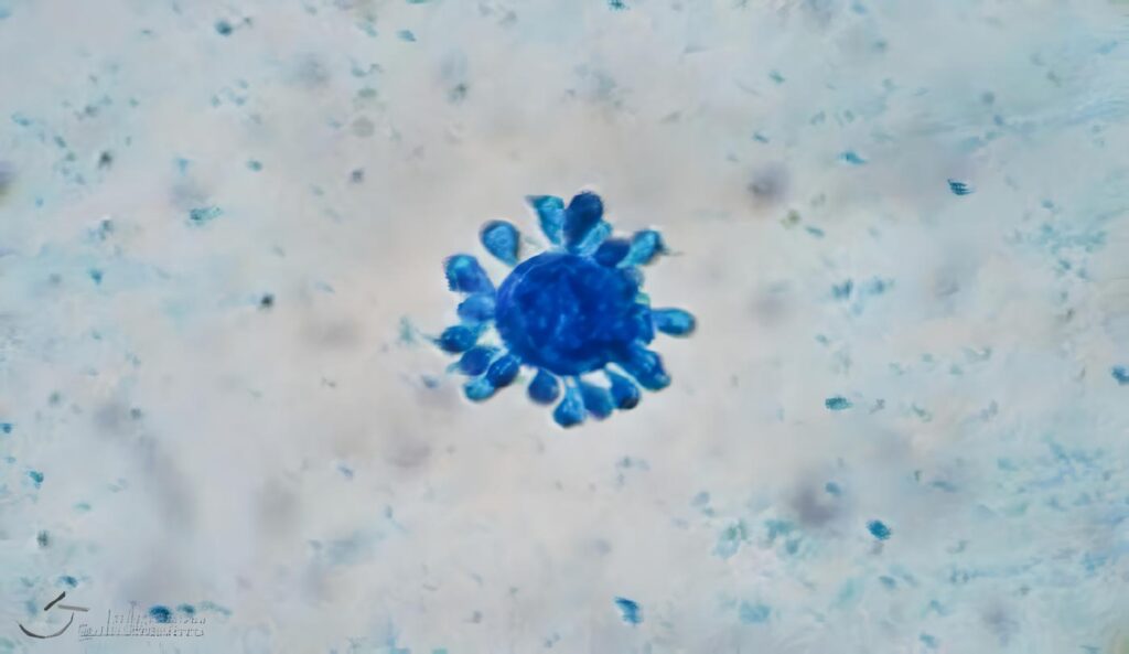 Mecanismo Fungicida de Macrófagos Activados con IFN-G contra Conidias de Paracoccidioides Brasiliensis