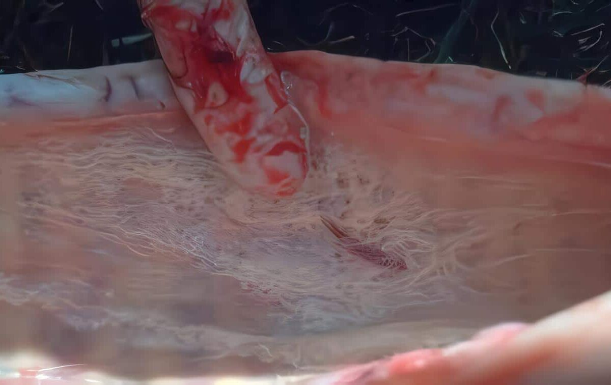 Carbón Bacteriano