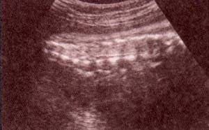 Diagnóstico Prenatal - corte sagital. 36 semanas