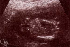 Abdomen Fetal Normal, Aspecto Global