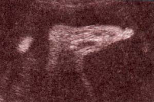 Diagnóstico Prenatal -  36 semanas.perfil del pie