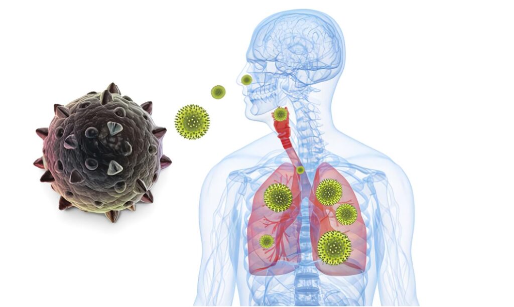 Prevalencia de Aeroalergenos como Causa de Síntomas Respiratorios