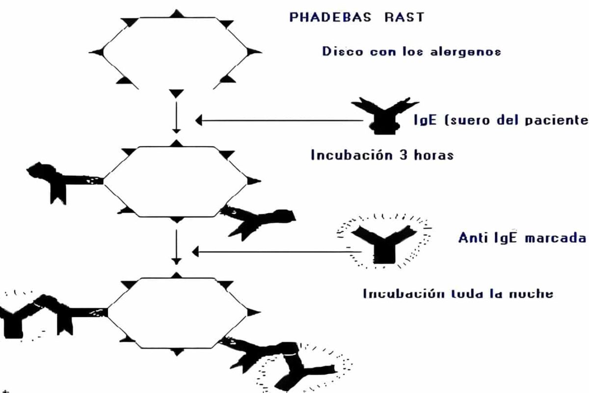 Inhibición del RAST