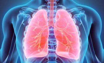 Seguimiento y manejo ambulatorio del paciente con enfermedad pulmonar crónica