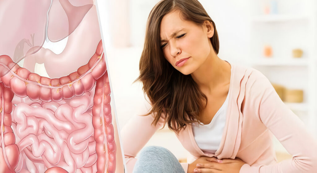 Sindrome Malaabsorción Grasas