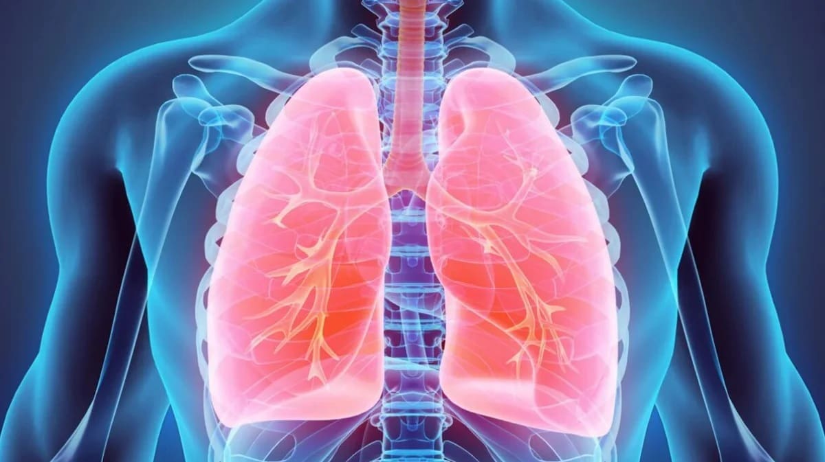 Enfermeedad pulmonar obstructiva crónica