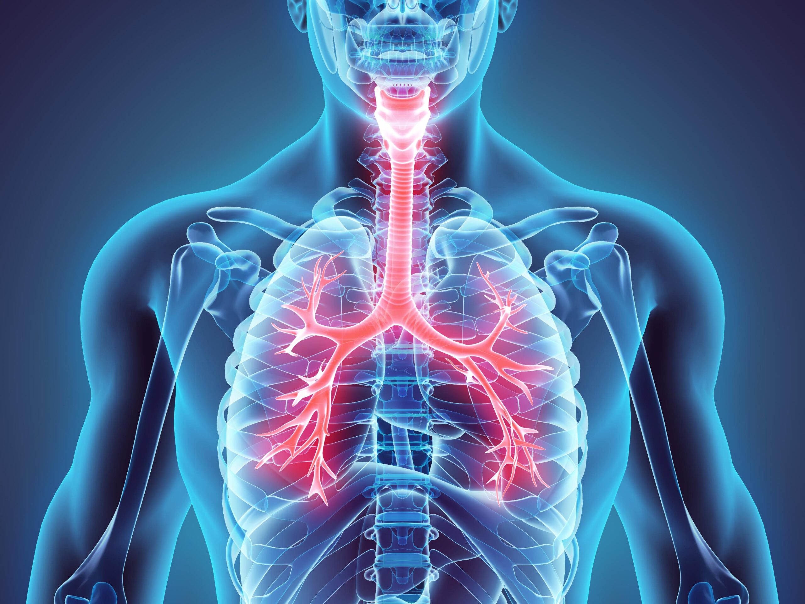 Granulomatosis de Wegener