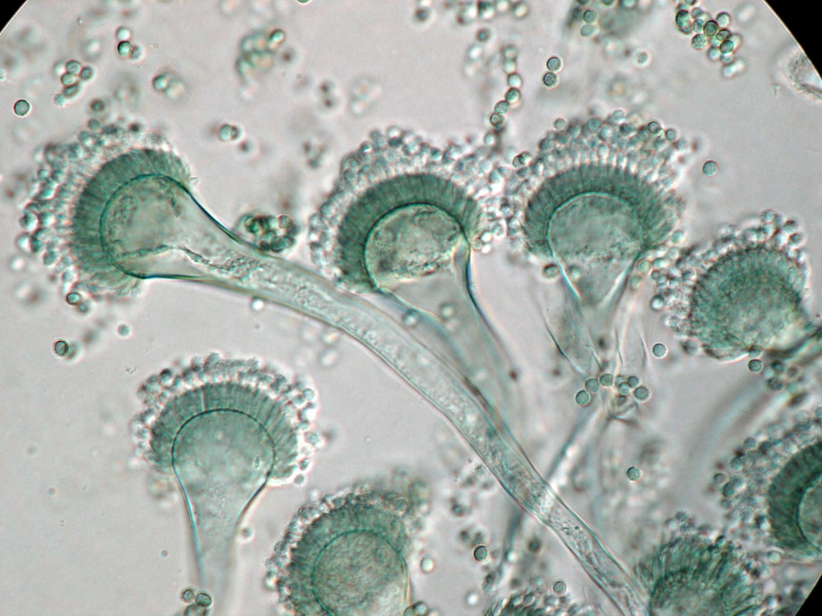 Micosis pulmonares