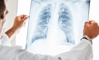 Nódulo pulmonar