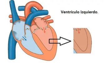 Disfunción ventricular izquierda (VI) Pruebas funcionales del ventrículo izquierdo