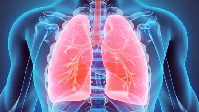 Trombosis fatal de las venas pulmonares como complicación precoz post trasplante de pulmón