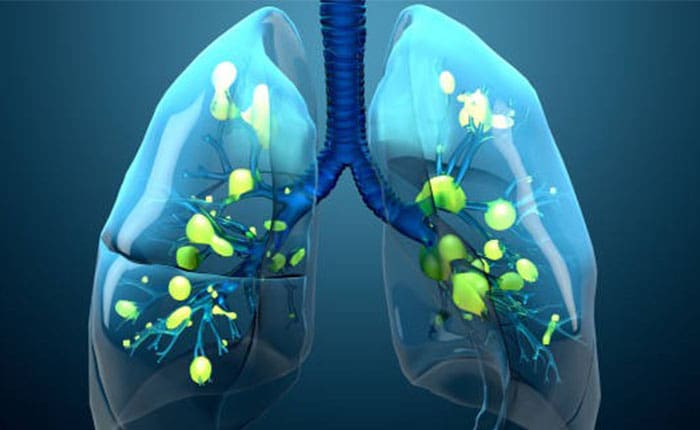 Contaminación ambiental y enfermedad respiratoria