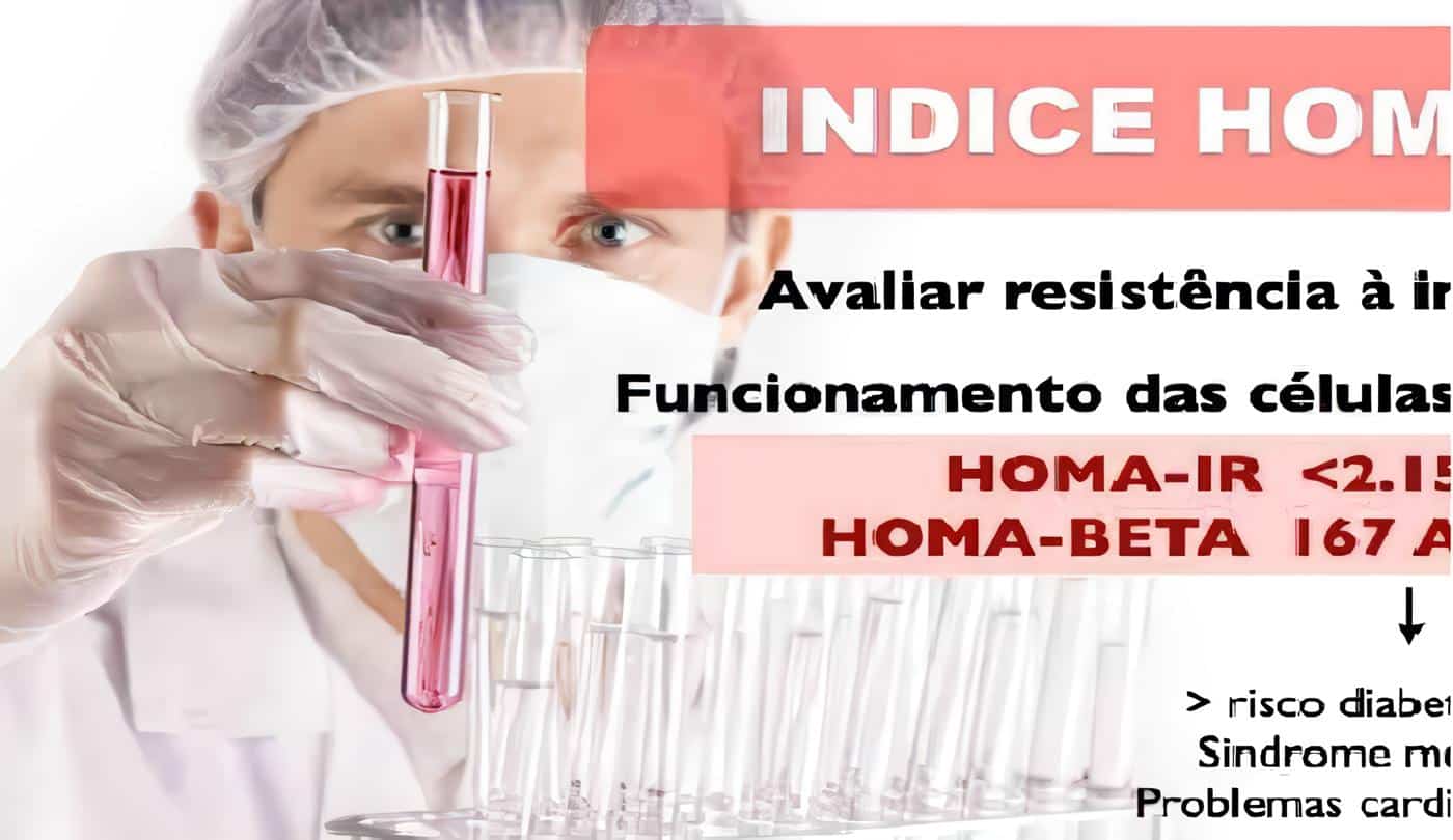 Índice HOMAIR