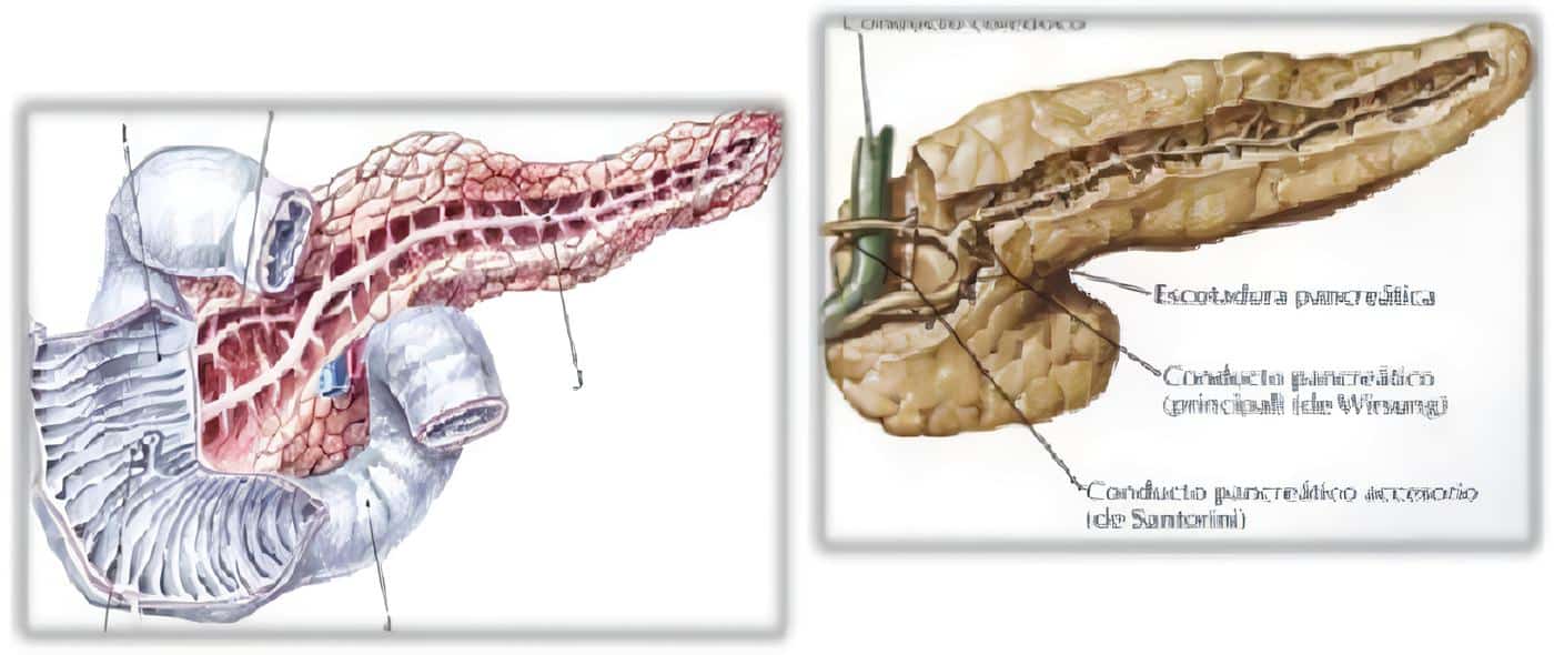 Pseudoquistes