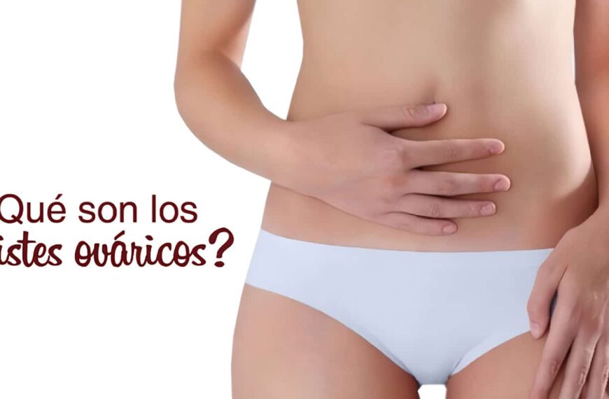 Quistes Ováricos Funcionales