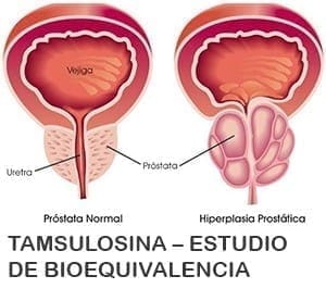 Tamsulosina – Estudio de Bioequivalencia