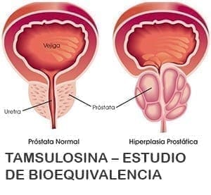 puede luchar por caca y causar problemas de próstata puede luchar por caca y causar problemas de próstata