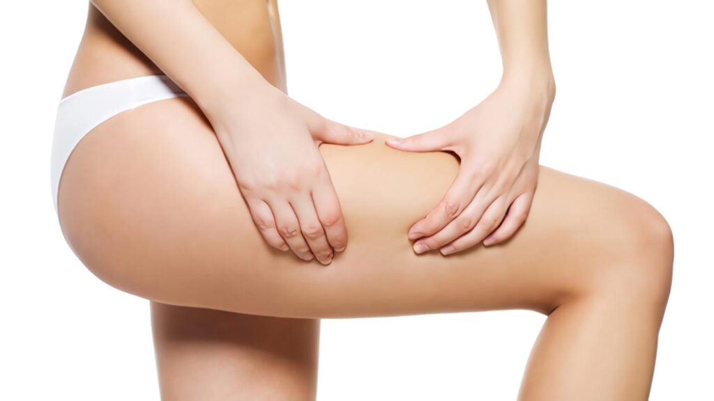 Celulitis cómo Combatirla