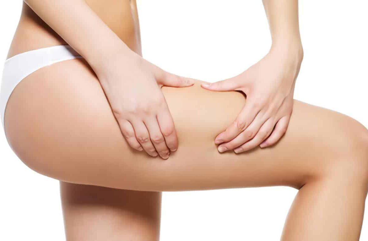 Celulitis - Cómo combatirla