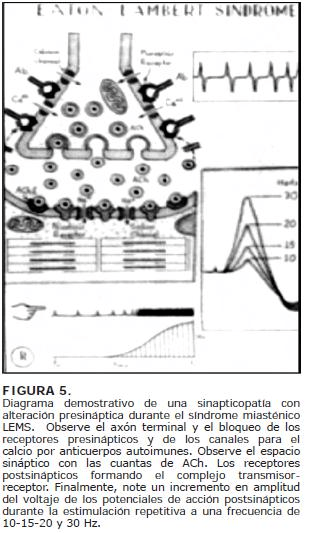 Diagrama demostrativo de una sinapticopatía