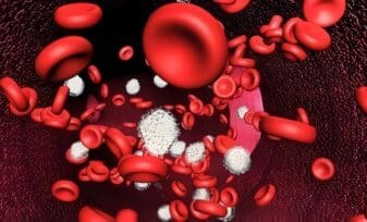 Anemia Megaloblástica y Manifestaciones Neuropsiquiátricas