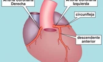 Arterias Cardiacas