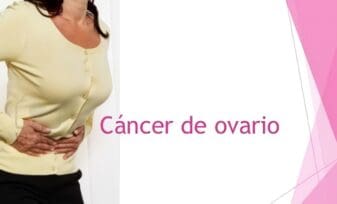 Cáncer de Ovario