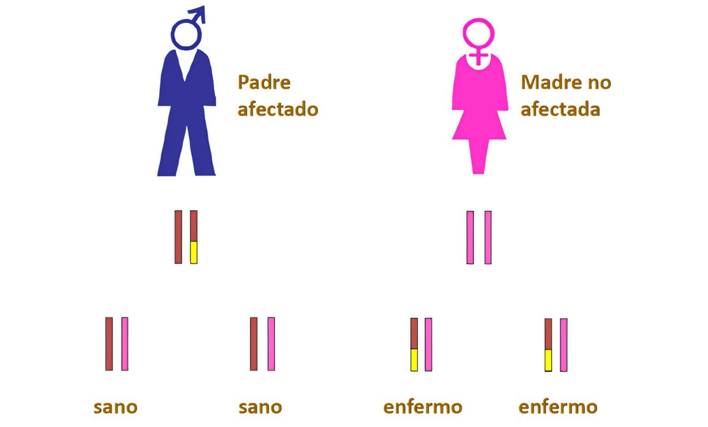 La mitad de los Cánceres de mama de Origen Genético son Herencia Paterna