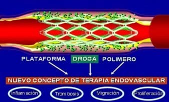 Endoprótesis Liberadoras de Fármacos