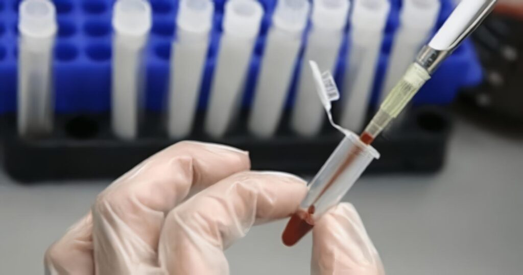 Nuevo Tipo de Fármaco Contra El VIH Frena El Virus