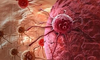 El Riesgo de Melanoma