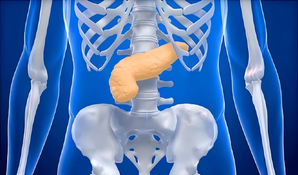 Nuevo Fármaco aumenta la Supervivencia de los pacientes con Cáncer de Páncreas