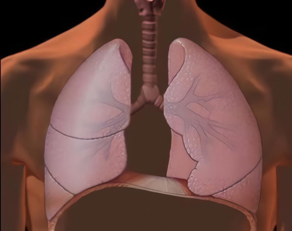 Rehabilitación Pulmonar