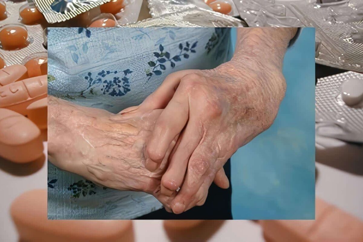 Tratamiento Artritis Reumatoide