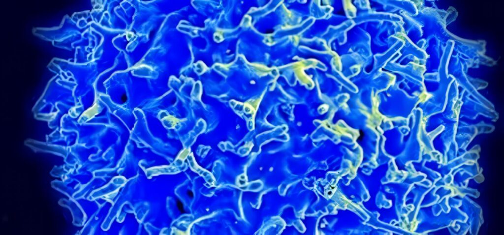 Variante Genética y Cáncer de Pulmón