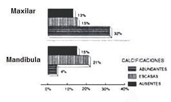 calcificacion-localizacion-anatomica