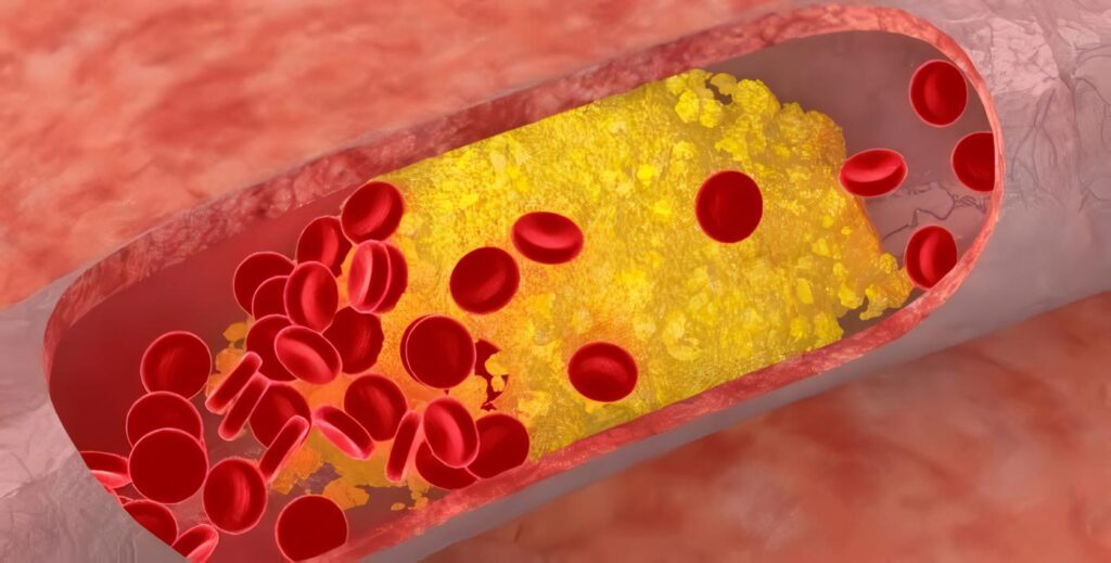 Mecanismo Genético que Apoya la Idea de que el Cáncer procede de Pequeños Grupos de Células Madre