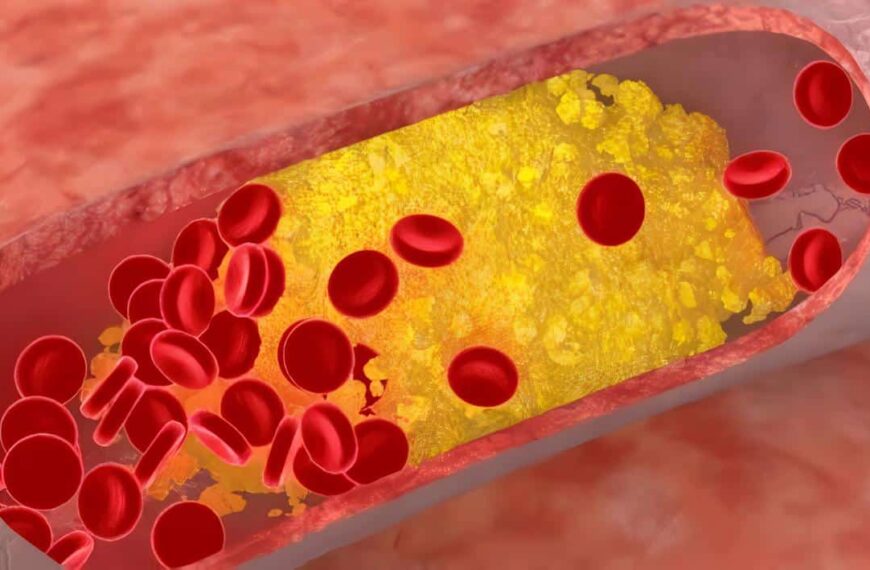 Mecanismo Genético que Apoya la Idea de que el Cáncer procede de Pequeños Grupos de Células Madre