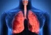 Estatinas retrasan el deterioro pulmonar en fumadores