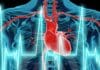 Dos Fármacos contra el Parkinson pueden Causar Daño Cardíaco